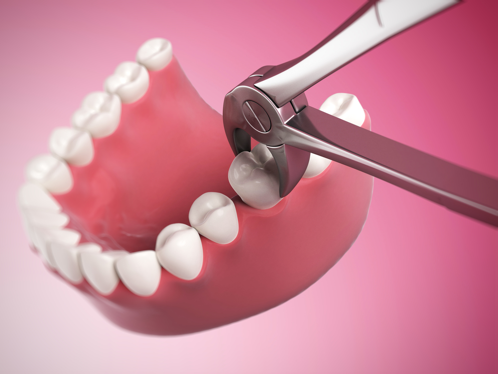 Болит десна после удаления зуба: что делать
