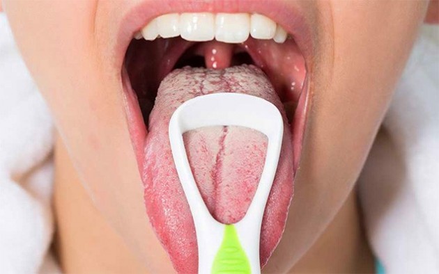 Противогрибковые препараты для полости рта