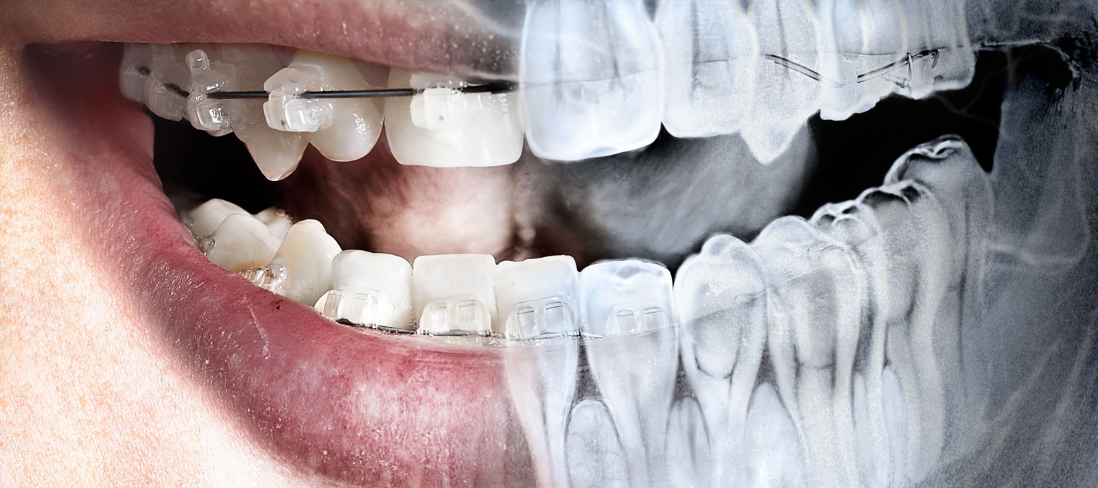 Рентген зубов: разновидности и вред для организма