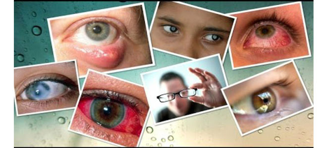 Инфекционные болезни глаз у человека