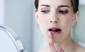 Прыщи в уголках губ, причины и лечение