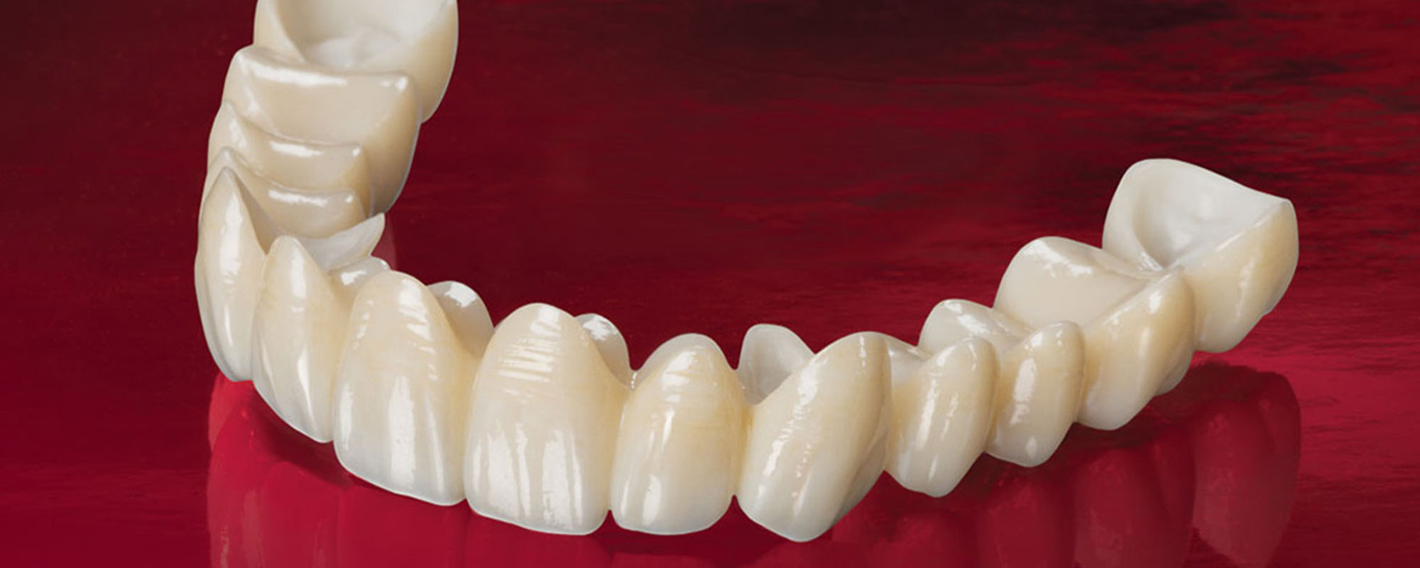 Можно ли отбелить металлокерамические зубы