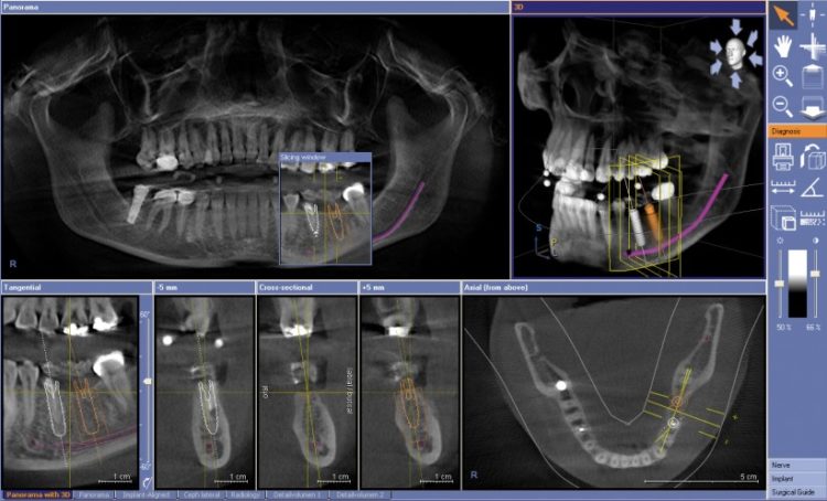 Компьютерная томография зубов: особенности проведения и противопоказания