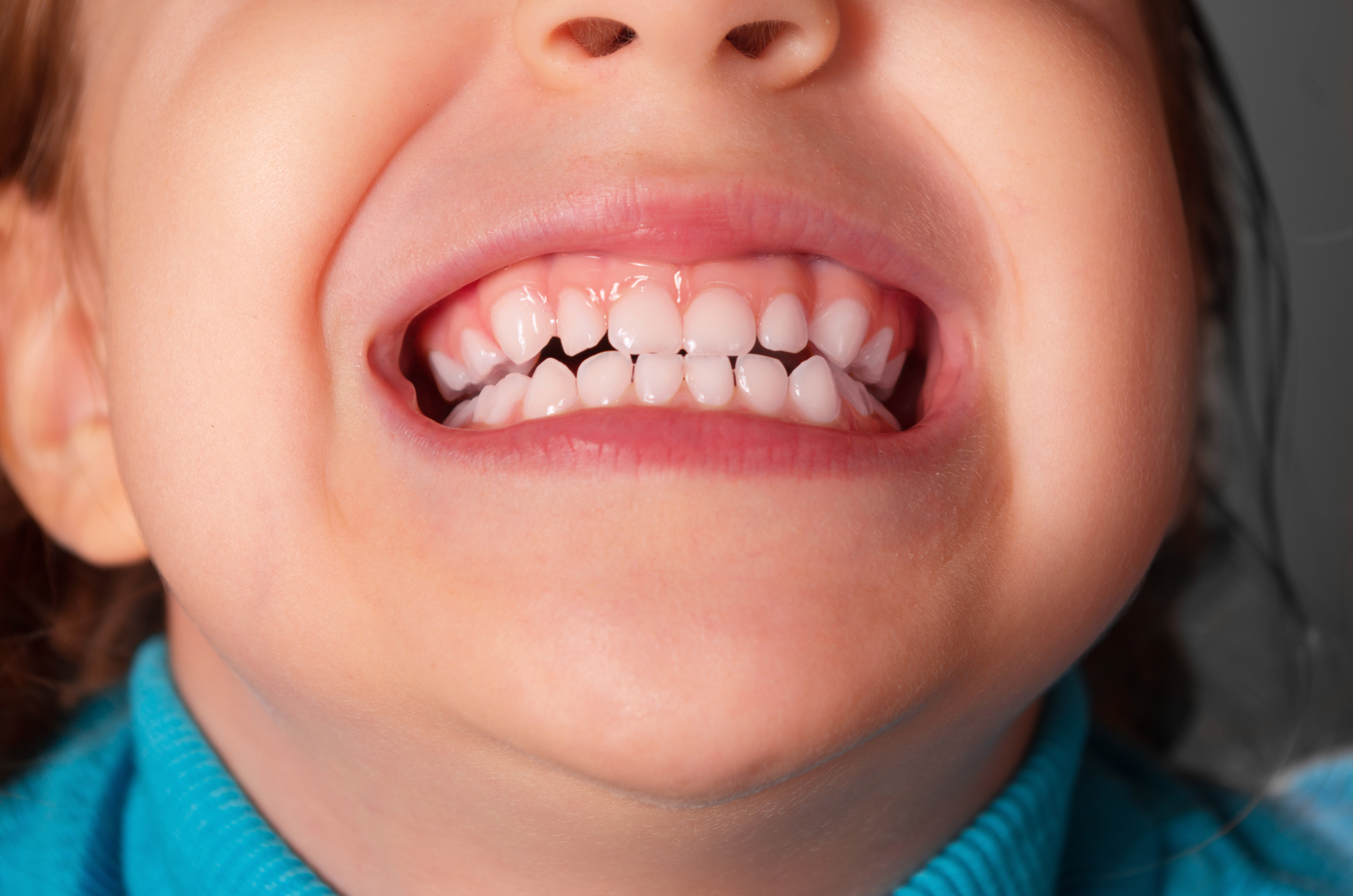 фото зубов у детей до года