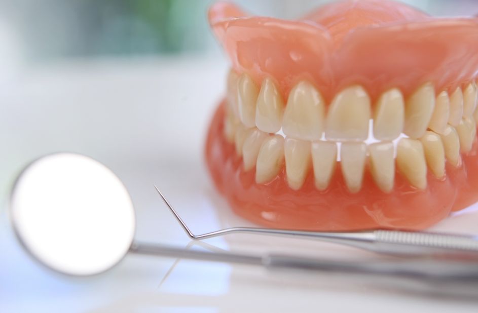 Виды съемных зубных протезов и уход за ними
