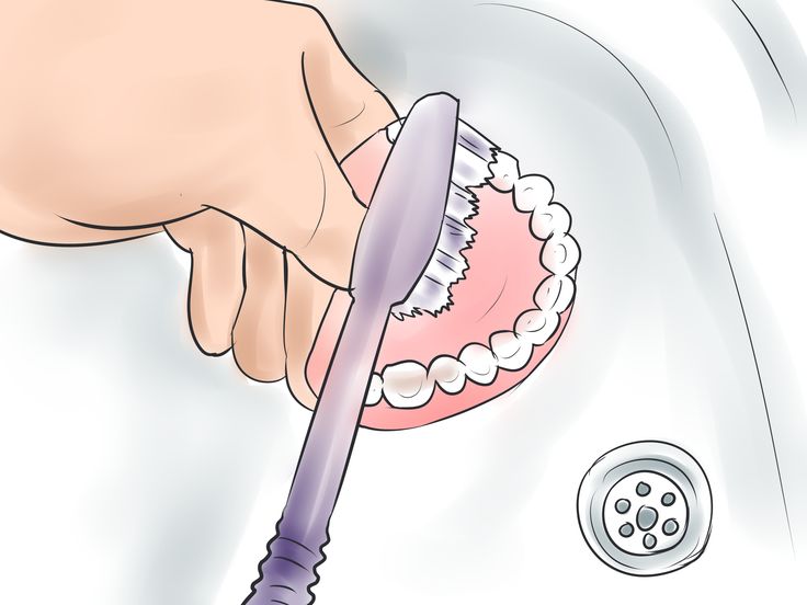 Узнаем, нужно ли снимать зубные протезы на ночь