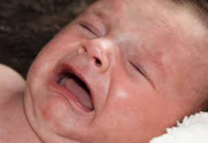 Массаж слезного канала у новорожденного