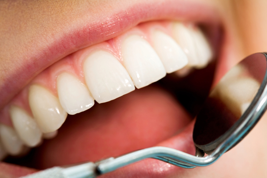 Как правильно ухаживать за зубами из металлокерамики?