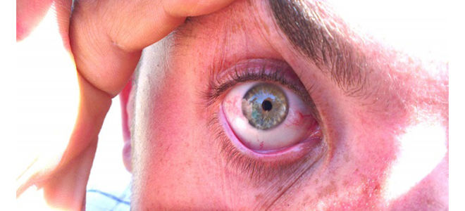 Ангиопатия сосудов сетчатки глаза
